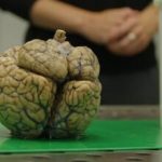 Waarom ons brein de dingen groter maakt dan ze zijn